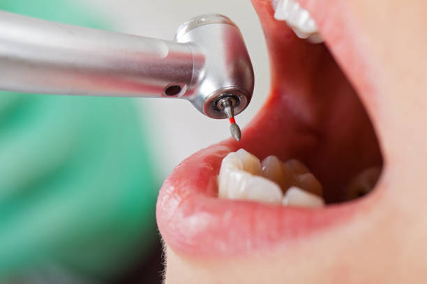 Best Emergency Dentist for Special Needs Patients in Montpelier, VT